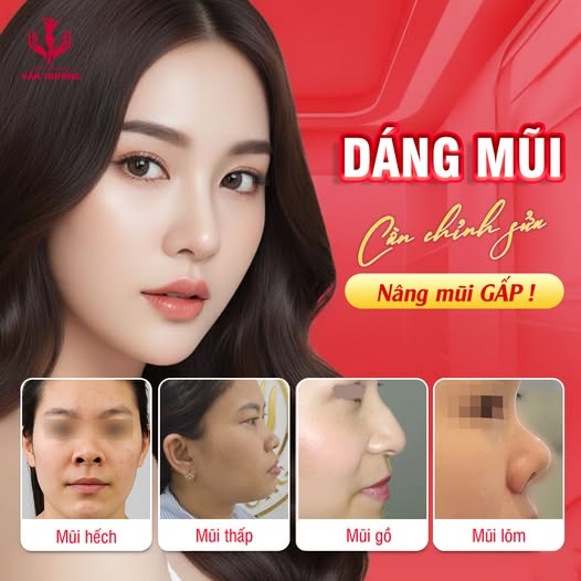 Sửa dáng mũi