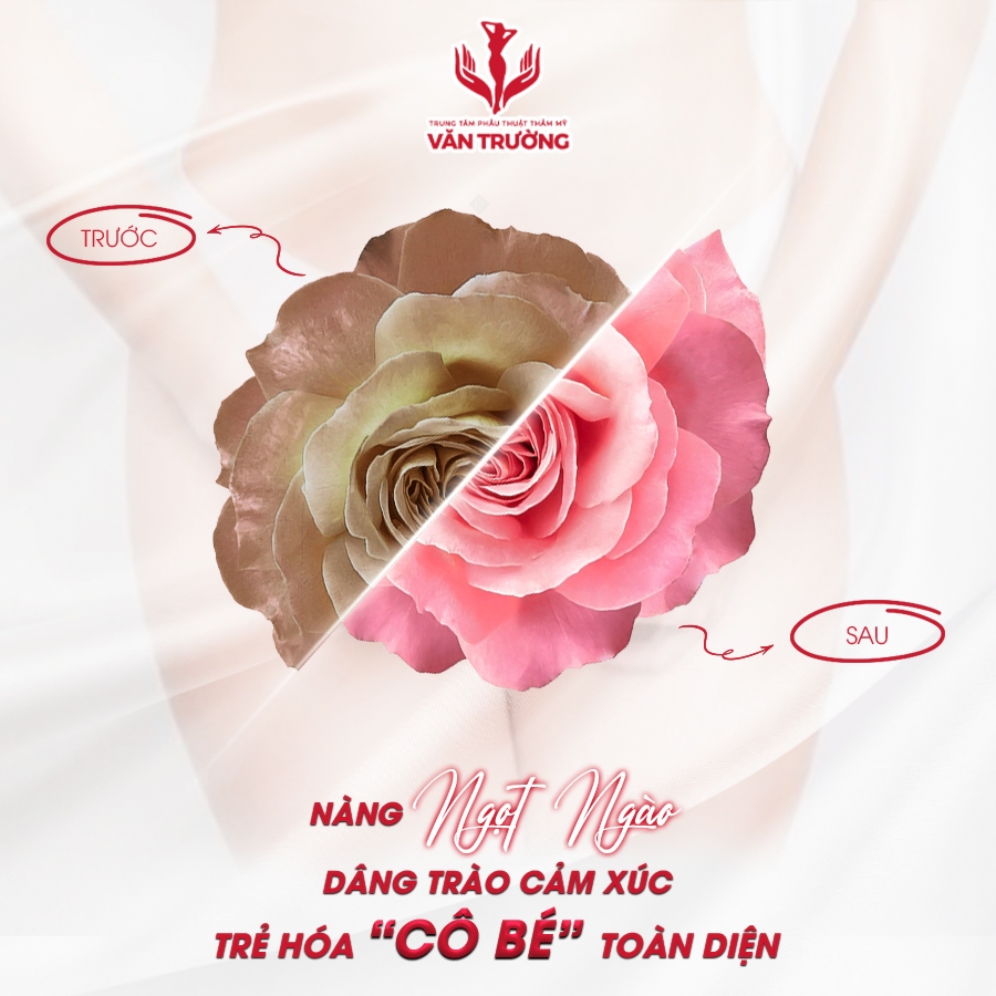 trẻ hóa "cô bé" toàn diện