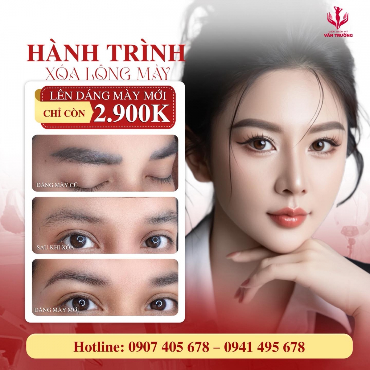 xóa mày cũ lên mày mới